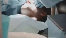 拔牙视频,揭秘拔牙全过程